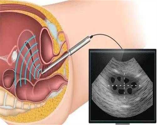 包男孩助孕机构_代生包成功价格,
              左侧卵巢有畸胎瘤意外怀孕后会有