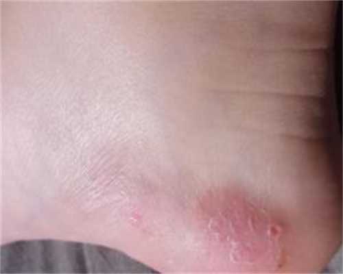 2026长治不孕不育医院排名，本地姐妹推荐助孕机构介绍