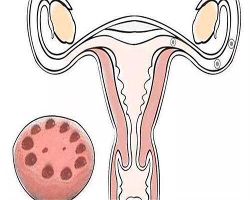 昆明供卵哪里可以,昆明试管婴儿哪个医院_昆明试管婴儿哪个医院做得好成功率