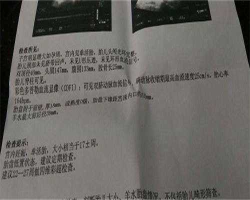 长沙供卵生女儿供卵捐卵公司