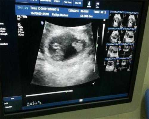 做代孕多少费用,武汉看痔疮好评率TOP医生攻略