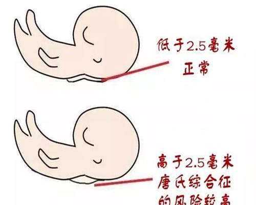 国内供卵医院哪家强_三代试管代孕哪里可以做,胚胎移植后10天出血真不一定是